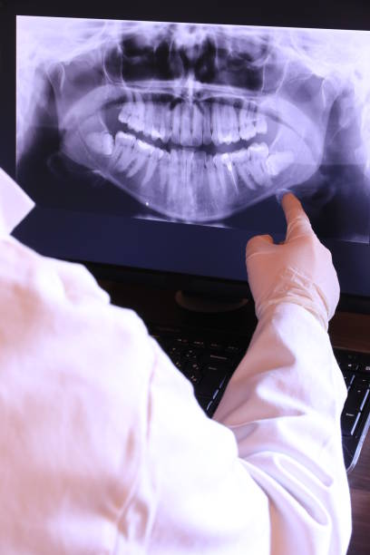 Best Emergency Root Canal Treatment in Heritage Lake, IL